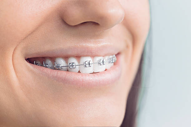 Dental Inlays and Onlays in Norway, MI